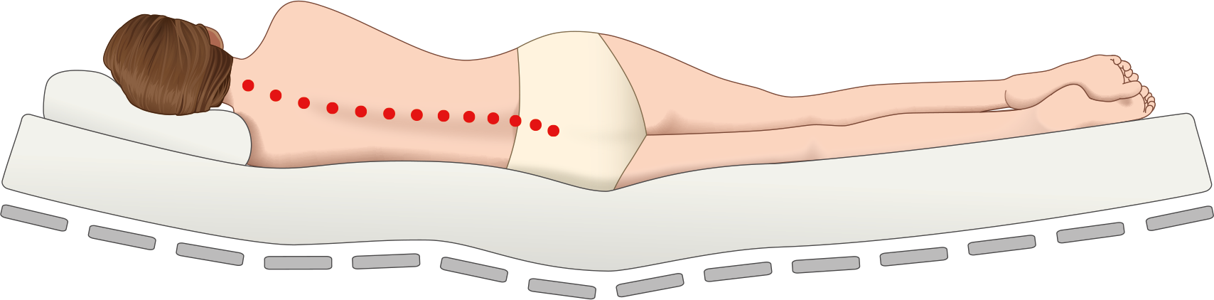 Zu weiche Matratze — Wirbelsäule hängt durch